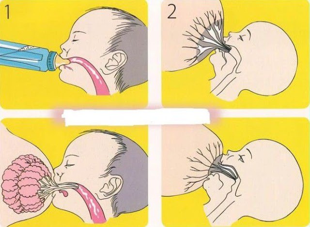Perbedaan Bayi yang Minum Susu dari Botol Dengan yang Menyusu Langsung Pada Ibu